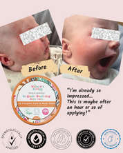 Organic Soothing Baby Balm