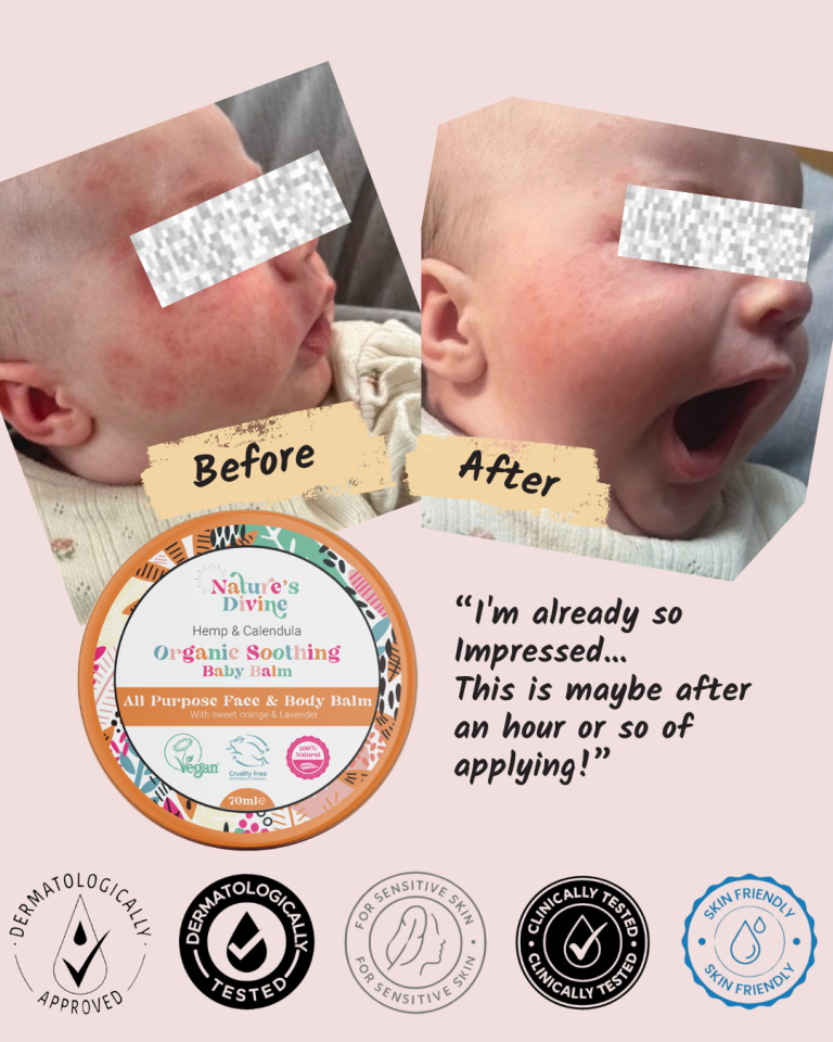 Organic Soothing Baby Balm